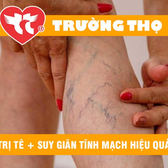TRỊ TÊ + SUY GIÃN TĨNH MẠCH HIỆU QUẢ